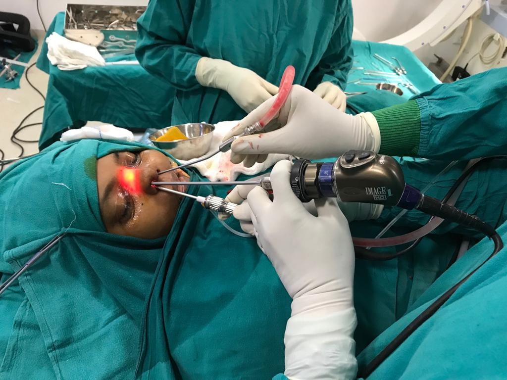 Endoscopic Sinus Surgery